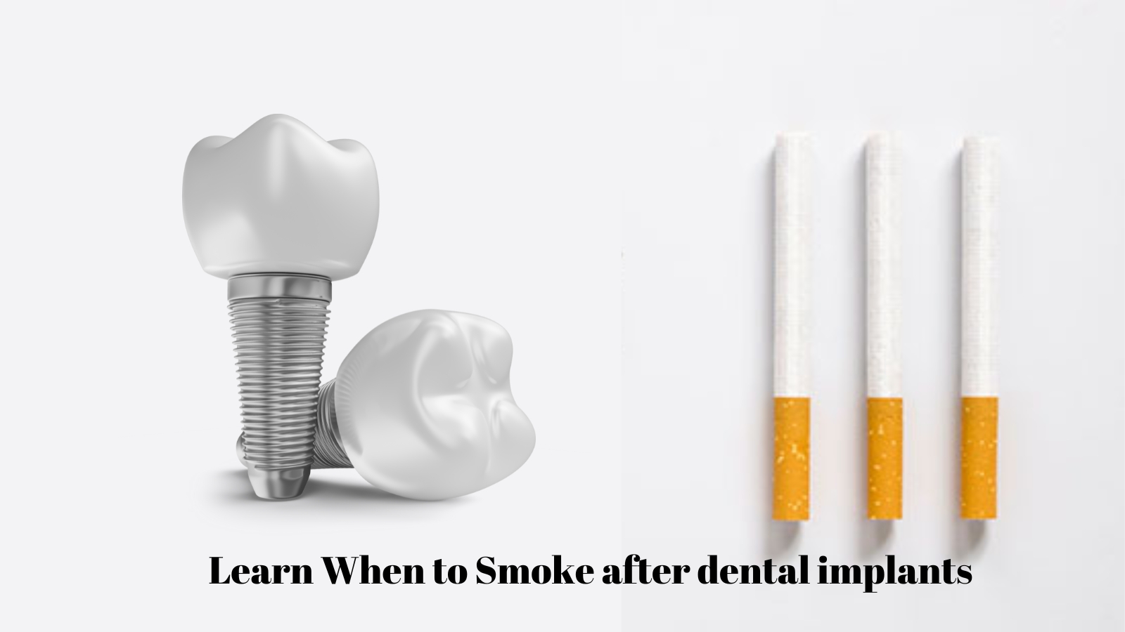 Timing Matters: When Can You Smoke After Dental Implants?, image size:1600x900